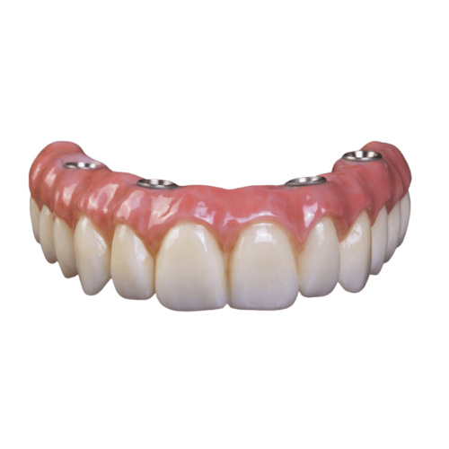 Clínica Providente - Prótese Protocolo